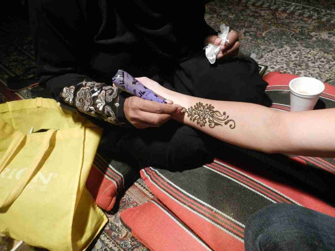 「タトゥーはアート」それMRI検査ができなくなっても言えますか？形成外科医が安易な“オシャレタトゥー”に対して思うこと