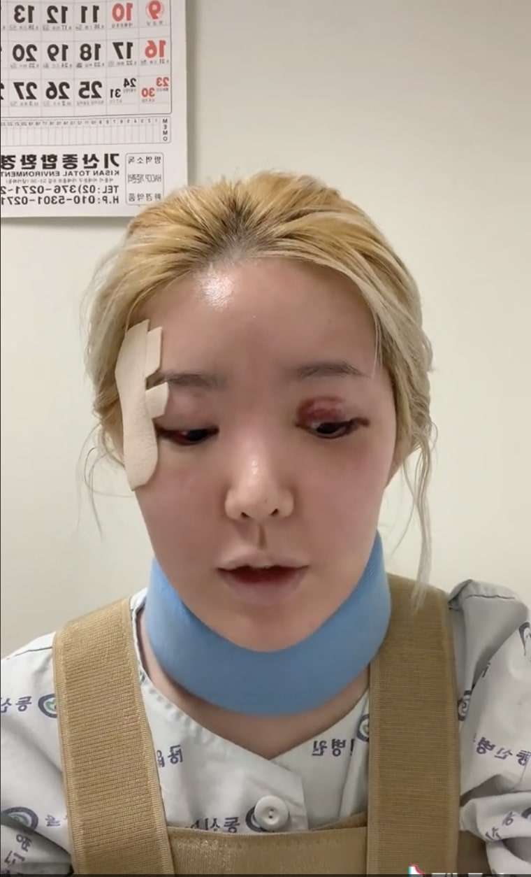 梨泰院の転倒事故から1カ月。生存者が語る「なんで今、自分が生きているのか…」