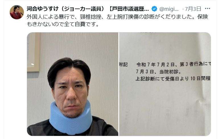 戸田市議「ジョーカー議員」外国人の立ちション注意→殴られ→頸椎捻挫→首にコルセット姿公開