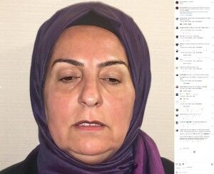 「ここまで変われるの？」トルコの美容整形のビフォーアフター写真が大炎上も、真相は？