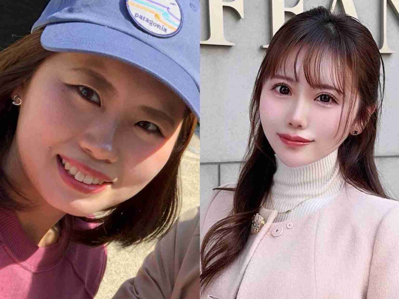 「一緒に二重にする？」母の言葉がきっかけで整形を決意、その理由に納得