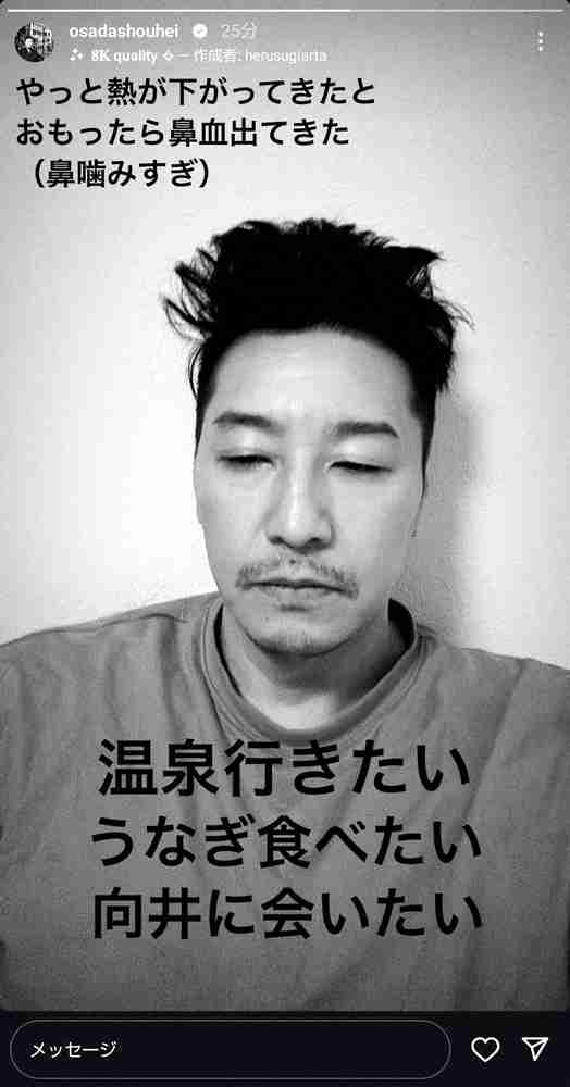 チョコプラ長田　原因不明の体調不良続く…「やっと熱が下がってきたと思ったら鼻血出てきた」