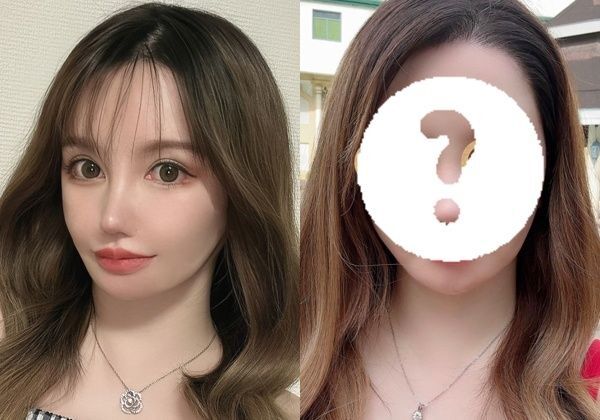 「とんでもない鼻にされてしまった」施術大失敗で顔面崩壊…フル整形4周目の女性、執刀医への怒り、赤裸々な心境を告白