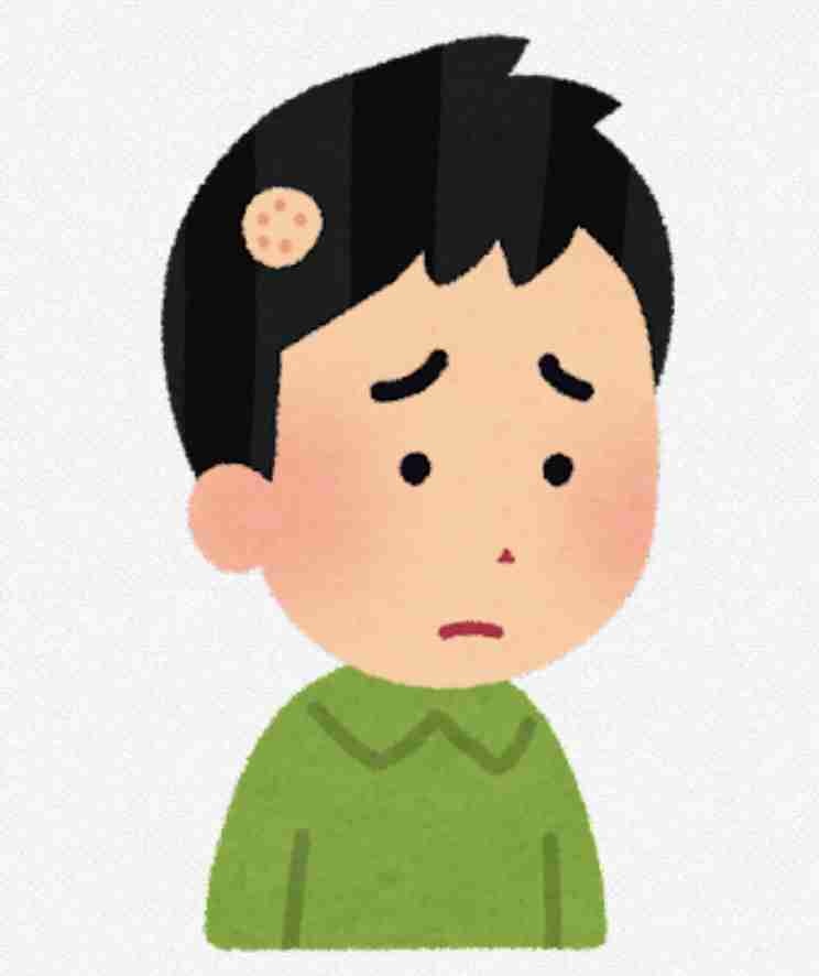 【悲報】円形脱毛症【情報交換】