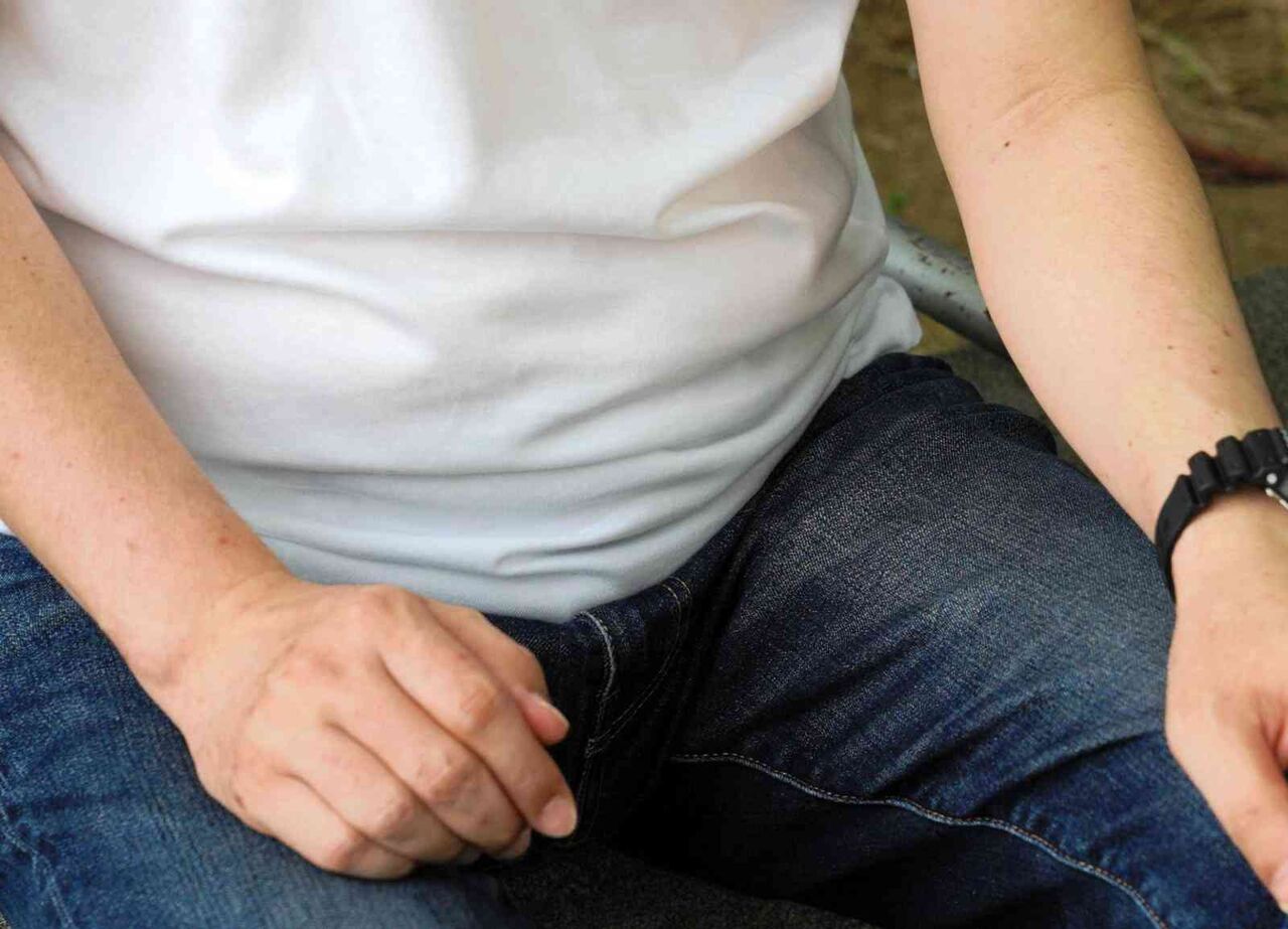 「ゴリラの食べ方」と言われ、「受け顎」の人生　50代男性「受け入れられた人は勝者なのか」