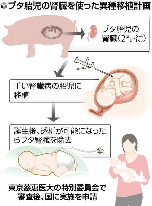 重い腎臓病の胎児にブタの腎臓移植、東京慈恵医大が学内審査へ…世界的に注目の「異種移植」