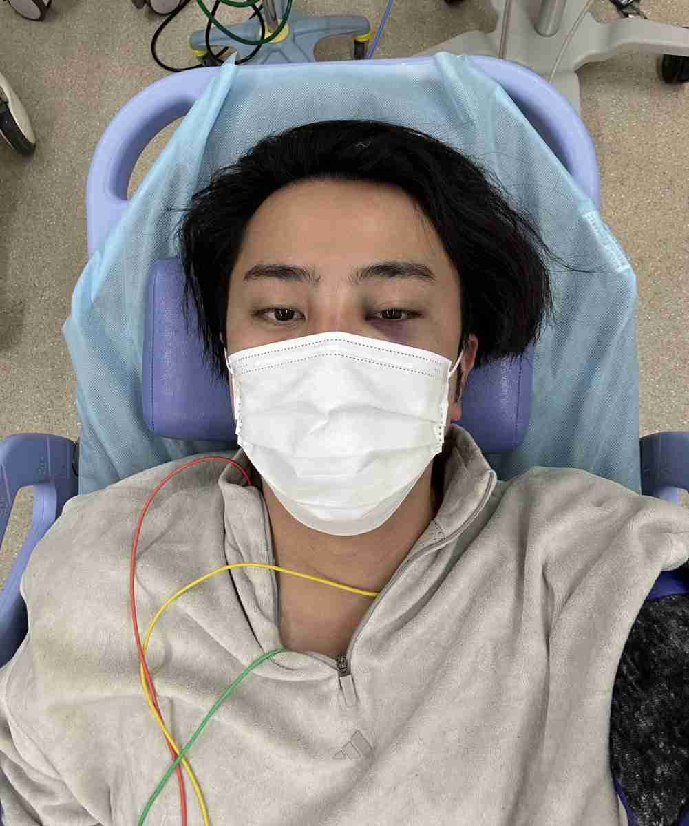 人気YouTuber・素潜り漁師マサル、「勘違いして殴られ」鼻の骨を折る大けが「酔った人に15発ぐらい」衝撃の投稿