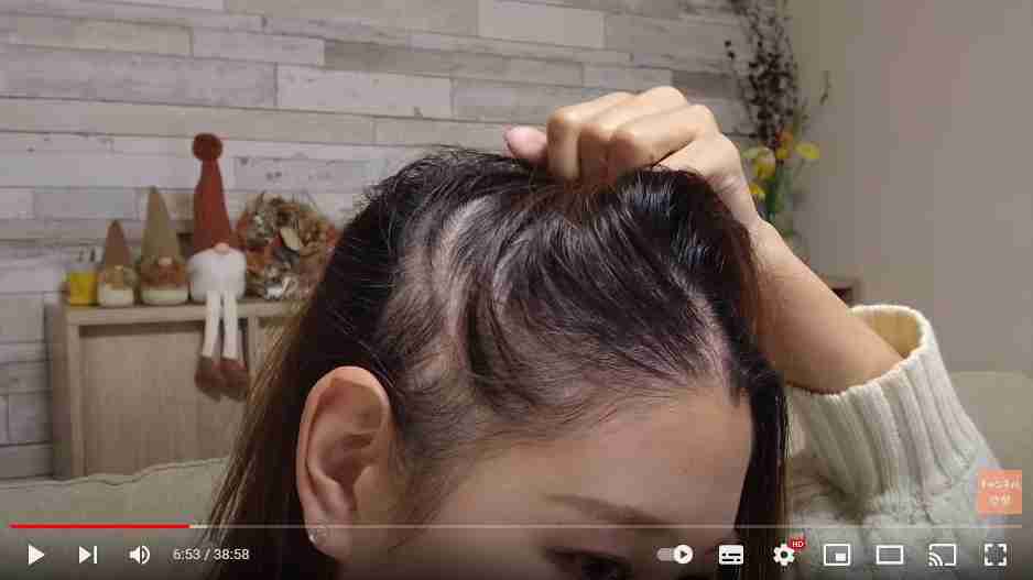 すい臓がん公表のYouTuber、詐病疑惑に「一番嘘であってほしいと思ってるのは私自身」　コレコレに診察への同行を呼びかける