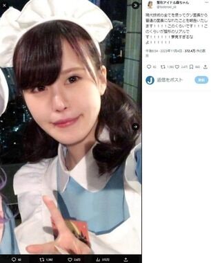 「このくらいが整形のリアルです！」整形1300万円アイドルが訴え　顔面ビフォーアフター投稿も...「夢見すぎるなよ！」