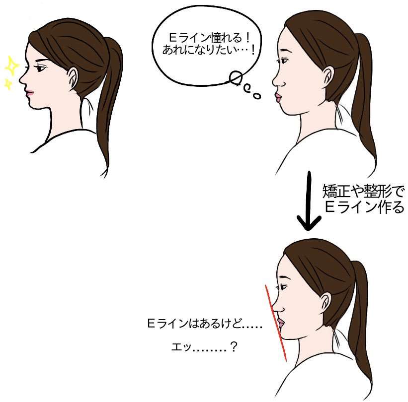 横顔がコンプレックス 骨格のせいだから諦めてます がーるずレポート