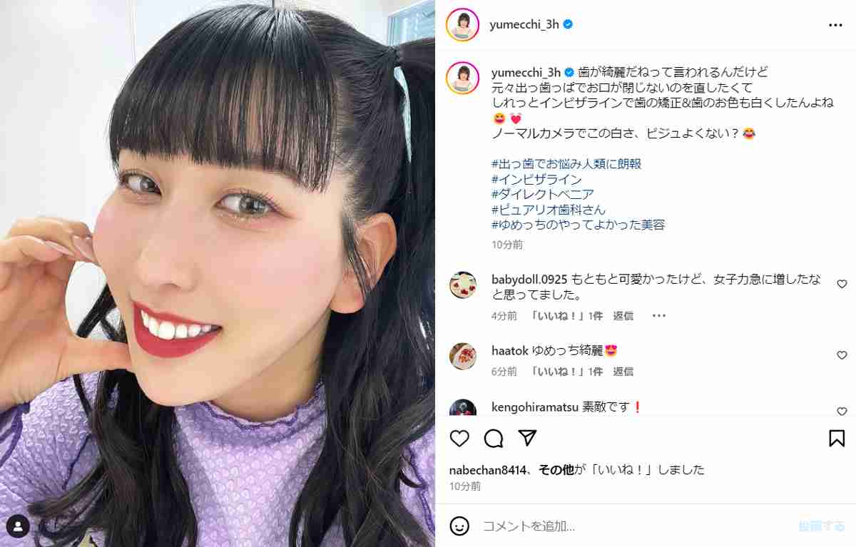 整形報告の「3時のヒロイン」ゆめっち、“歯”もアップデート　変化に喜び「この白さ、ビジュよくない？」