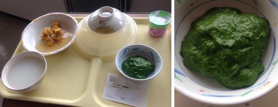 【速報】手術後の病院食、ひどい・・・