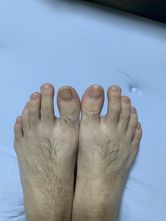 ワイより足の指長い奴おる?