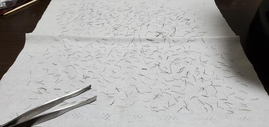 【画像】ワイ、１時間半かけてヒゲを抜き終わるｗｗｗ