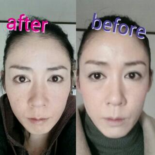 セルフ骨気で小顔 実証写真ありwww 最新 美容情報まとめ セルフ骨気で小顔 実証写真ありwww 最新 美容情報まとめ