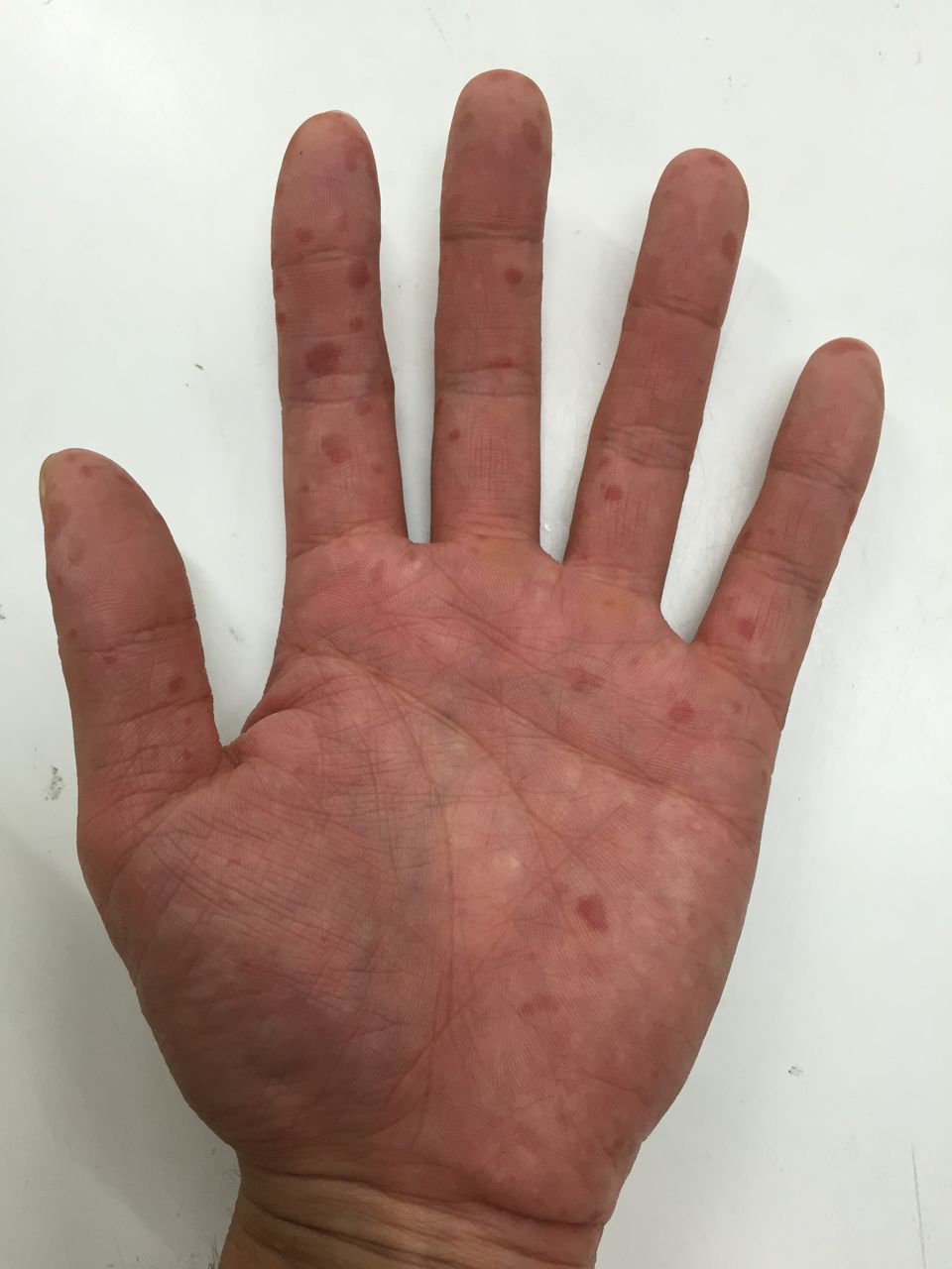 夏の疲れにご用心 渚にまつわるエクストラ