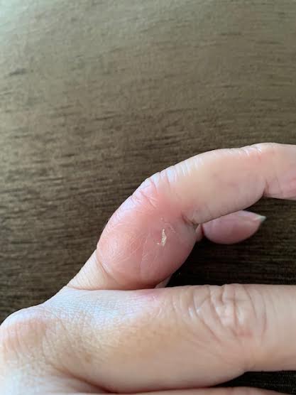 年明け最初の苦難 T T Everyday Happy Go Lucky