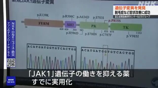 アトピー・脱毛症に光明か 新しい遺伝子変異を発見、治療薬の効果も確認
