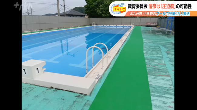 プールで泳いだ児童25人「手に湿疹としびれがある」→原因はプールサイドに手をついたことによる圧迫痕
