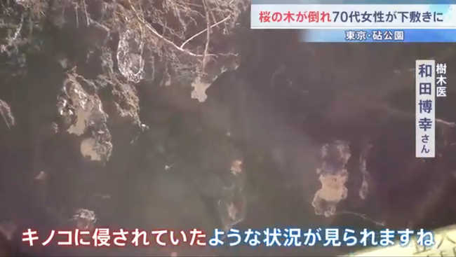 世田谷・砧公園で70代女性が倒木に巻き込まれる　根の腐朽が原因か