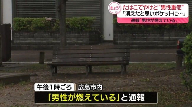 「たばこが消えたと思ってポケットに入れたら消えていなかった」 広島市内で男性が燃え重症