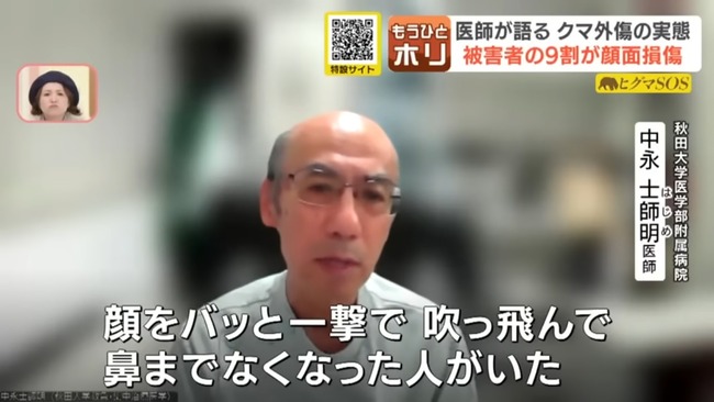 【悲報】クマ被害者、9割が顔面損傷
