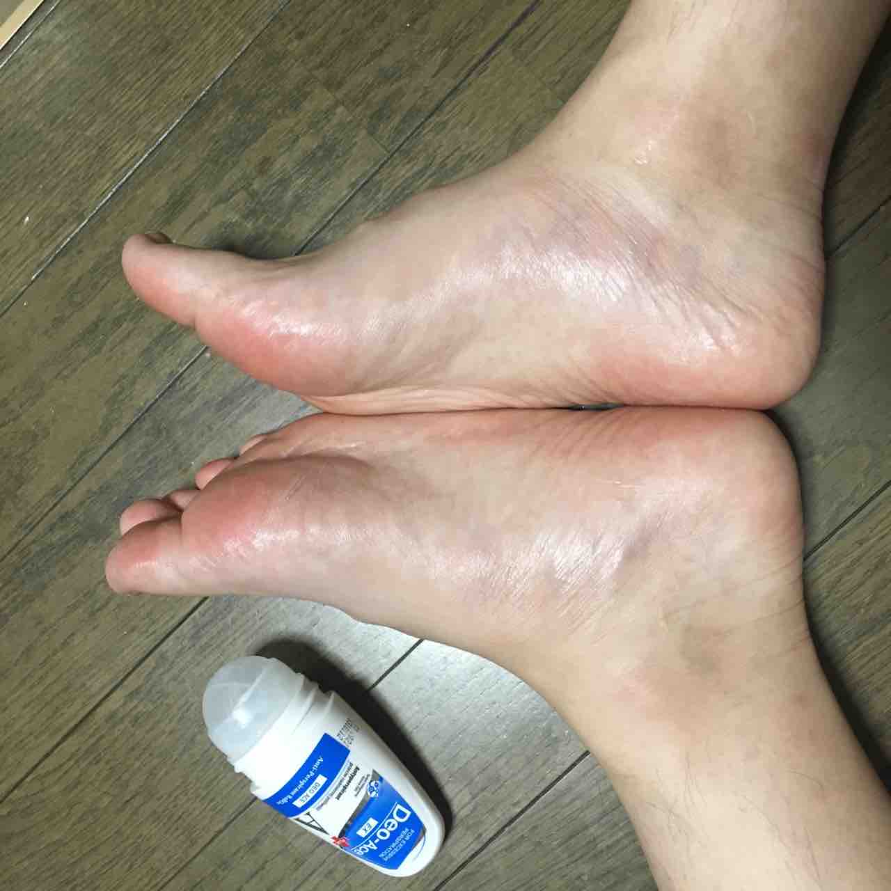 脂足対策 異常な足汗を抑えるにはどうしたらいい 脱臭王子 クサイのクサイの飛んでいけ