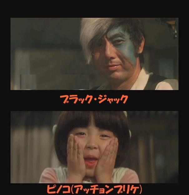 Amazon.co.jp: 瞳の中の訪問者 ブラックジャック レンタル版 DVD