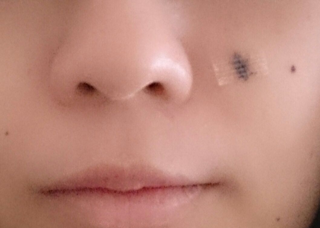 拡散する 外部 展望台 ほくろ 小さく Nonasart Org