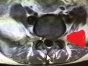 100115 mri1