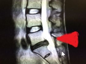 100115 mri2