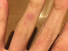 112715 ����2