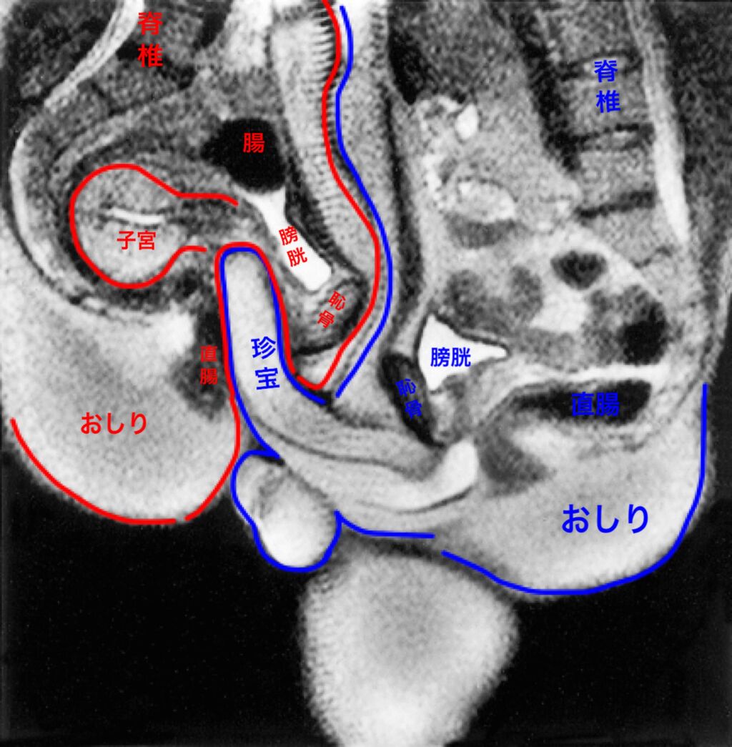 MRI まんこ 衝撃】 挿入したちんこは折れていることがMRIで判明wwwwwwwwwwwwwww : トム速報