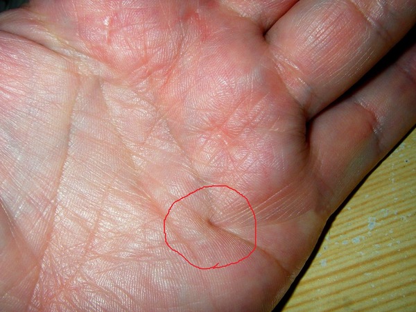 000-0-081803-2