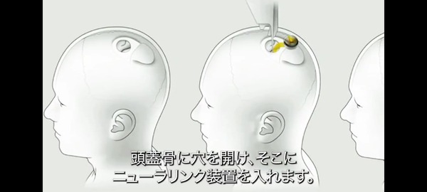 イーロン・マスク「外国語勉強してた人達、無駄です！ｗ」 脳に言語を直接ダウンロードする時代へ