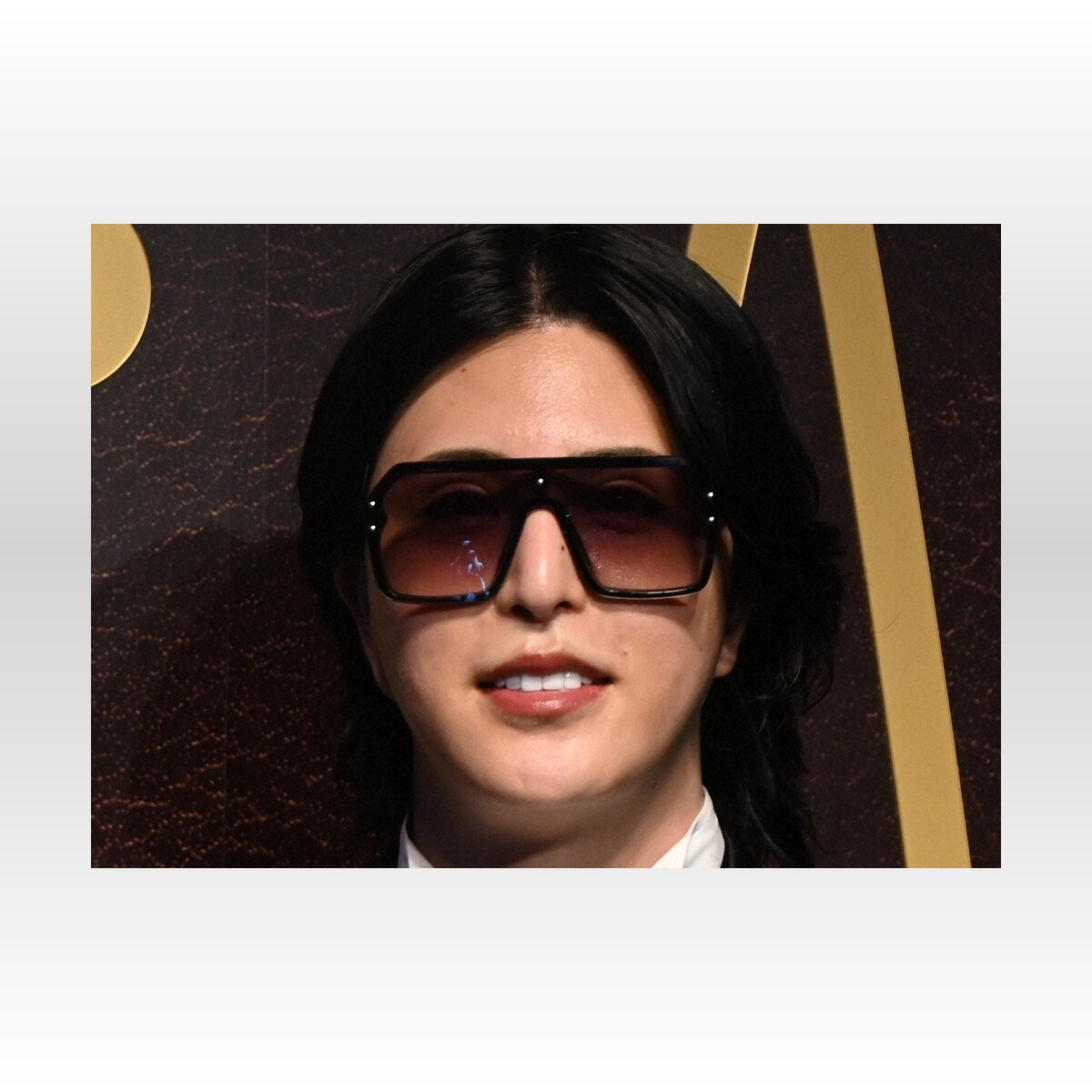 【芸能】ローランド、美容クリニック撤退の真相とは？年間億単位の赤字を直撃した理由