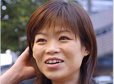 驚愕！だいたひかるがまた感染症に、腫れた腕と高熱の原因は？