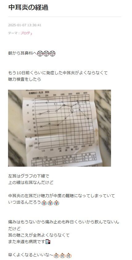 【悲報】中度の難聴になった川崎希の心境とは？耳の健康について考える