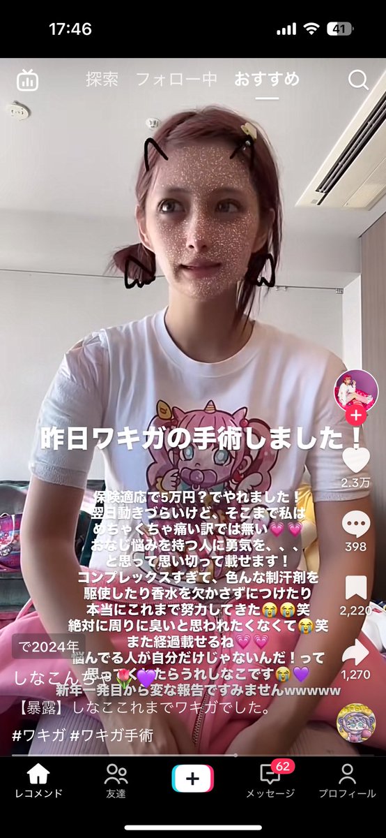 【芸能】しなこ、ワキガ手術の舞台裏を語る！保険適応でたった5万円の秘密とは？
