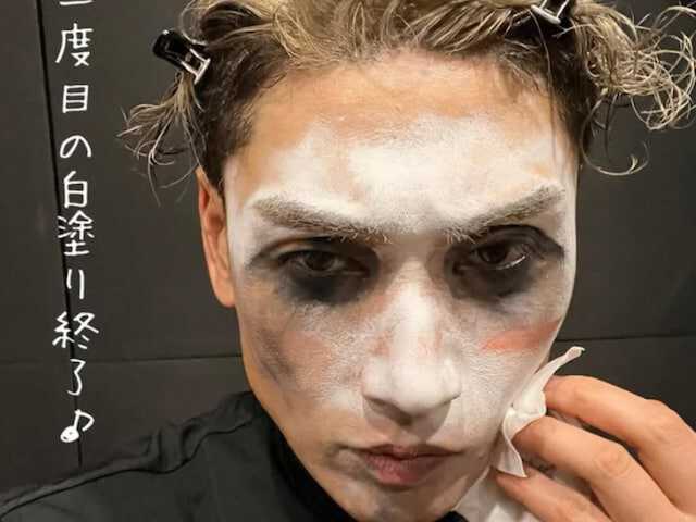 【閲覧注意】樽美酒研二の背中がヤバすぎる…全身蕁麻疹で「死ぬかと思った」衝撃告白に心配の声が止まらない！