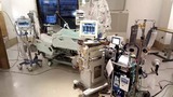 ecmo