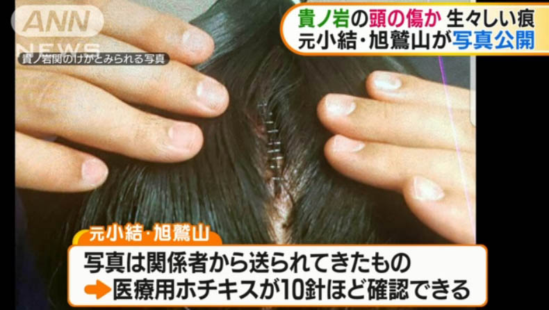 従業員が殴られてケガしてたら被害届ですよね hippo大野の雑記帳 従業員が殴られてケガしてたら被害届ですよね hippo大野の雑記帳