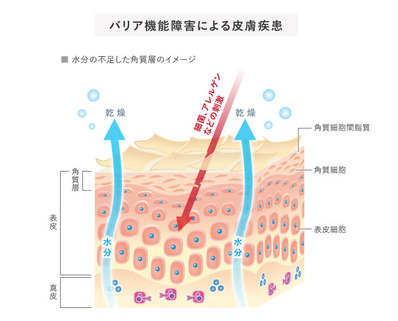 皮膚バリア機能