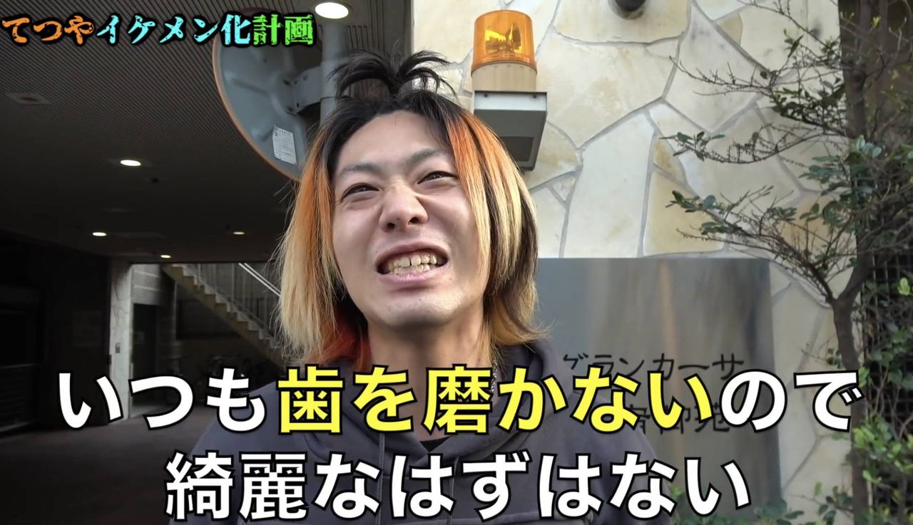 画像 超大物youtuber 歯がやばい 痛いyoutubeまとめ速報 画像 超大物youtuber 歯がやばい 痛いyoutubeまとめ速報