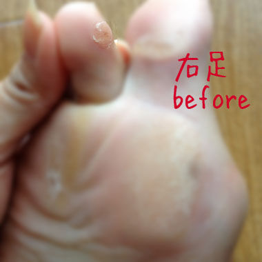 f:id:guchi35sai:20160623144909j:plain