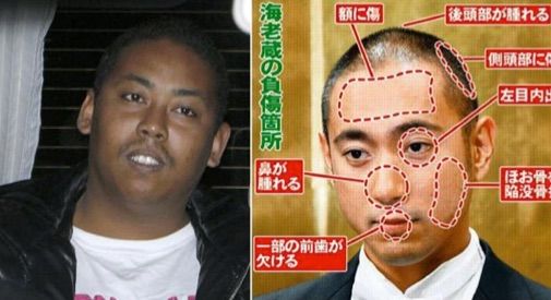 鳥肌注意 海老蔵をフルボッコした伊藤リオンの現在がとんでもないことになっていた 出所後 山 組から連絡があり 画像あり 気になるニュース 鳥肌注意 海老蔵をフルボッコした伊藤リオンの現在がとんでもないことになっていた 出所後 山 組から連絡があり 画像あり 気になるニュース