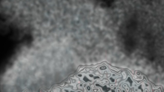 00435