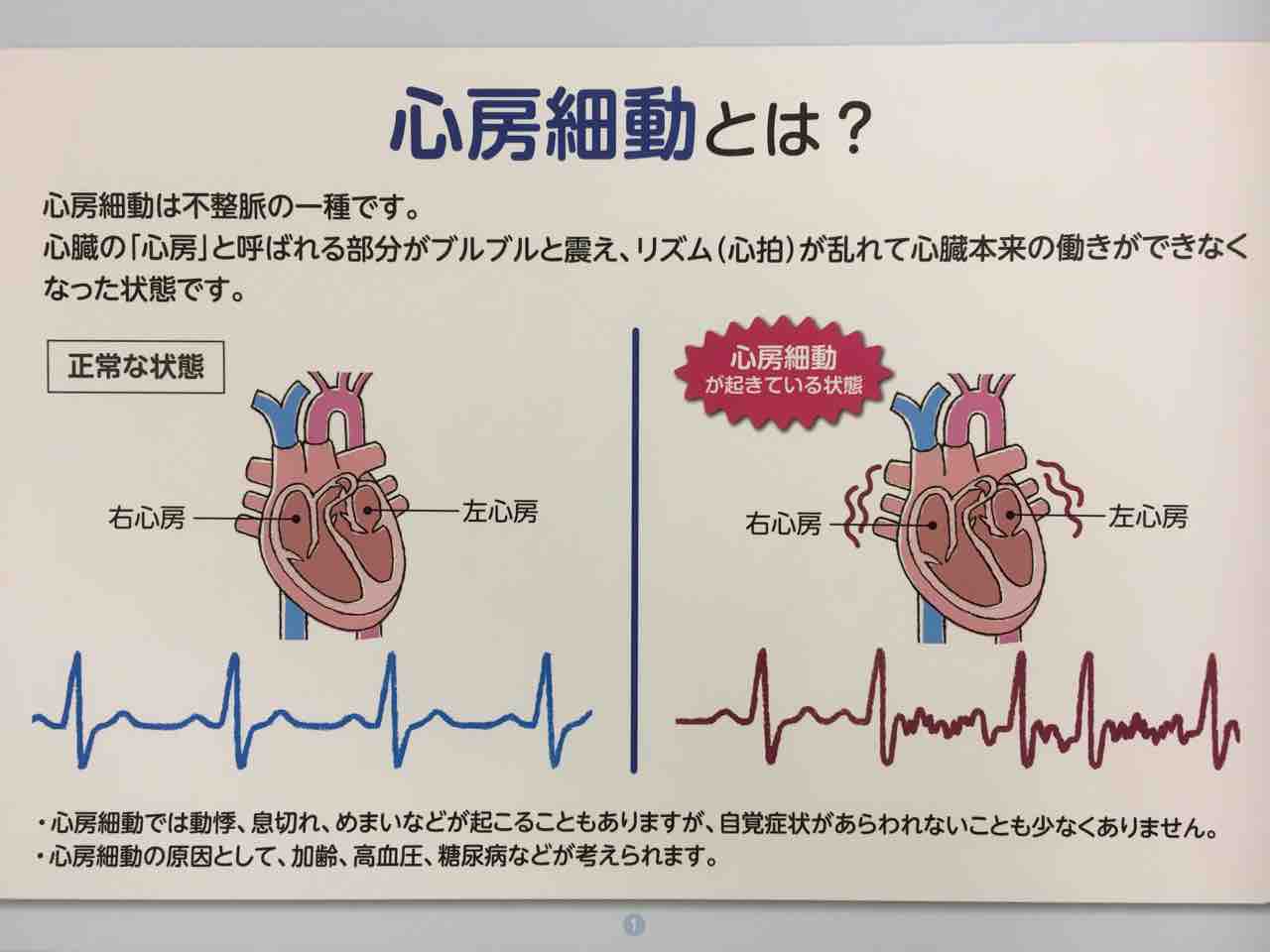 原因 脳 梗塞