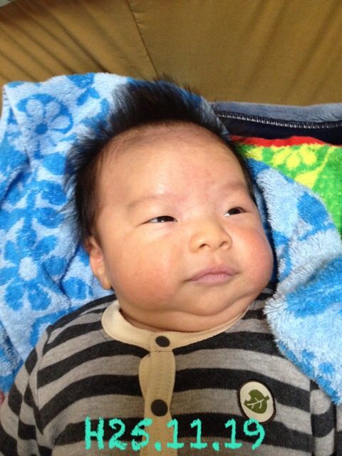 乳児湿疹 はちこblog 乳児湿疹 はちこblog