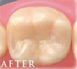 after In